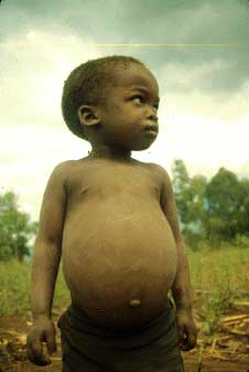 Real hunger